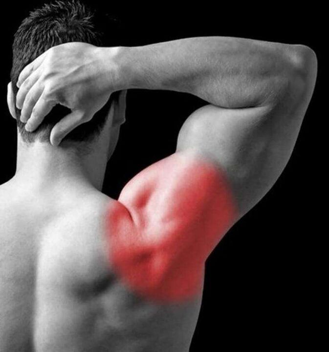 біль у плечі і потилиці при шийному остеохондрозі