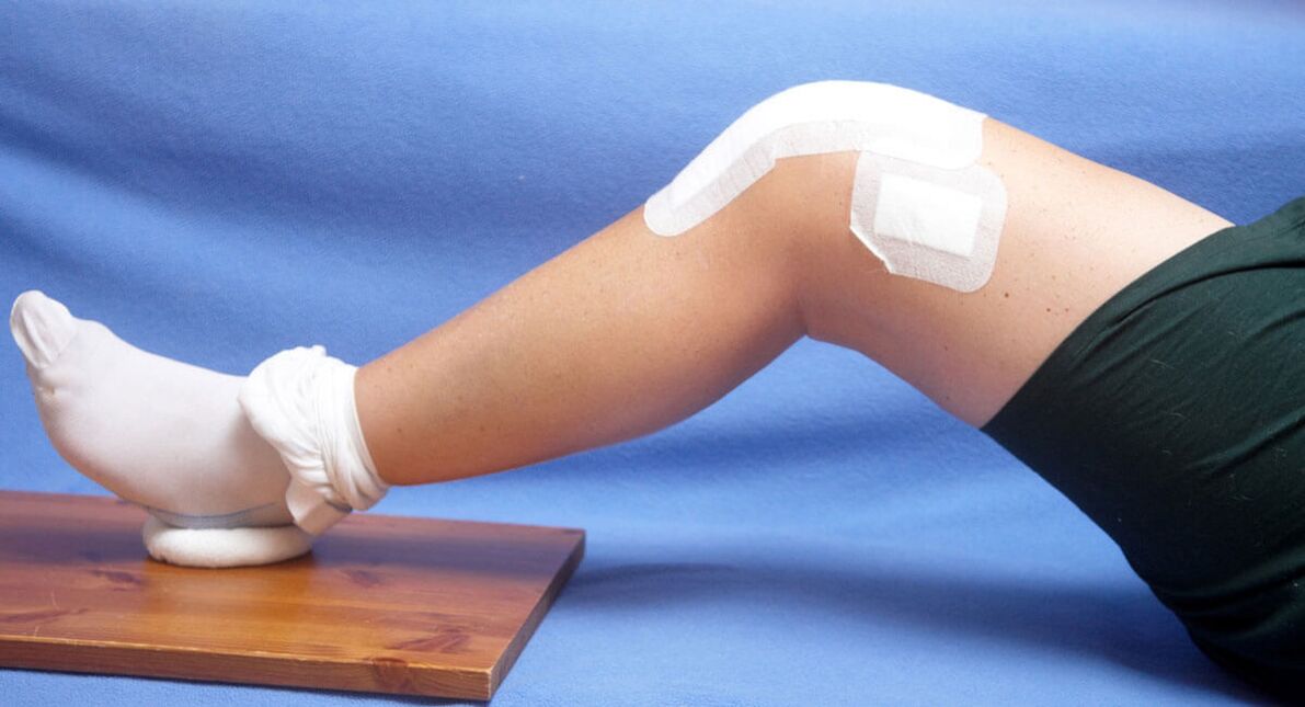 травма колінного суглоба як причина артрозу